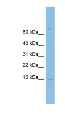 LSM6 Antibody, Novus Biologicals:Antibodies:Primary Antibodies