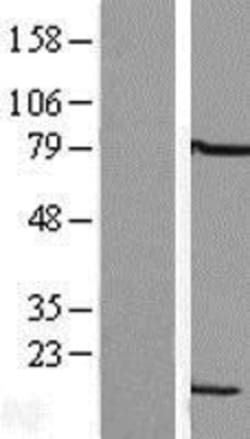 Novus Biologicals&trade;&nbsp;LSM6 Overexpression Lysate