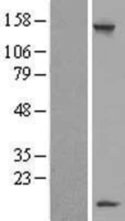 Novus Biologicals&trade;&nbsp;LSM7 Overexpression Lysate