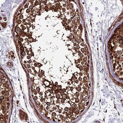 LSM7 Antibody, Novus Biologicals 25 &mu;L, Unconjugated:Antibodies, Polyclonal