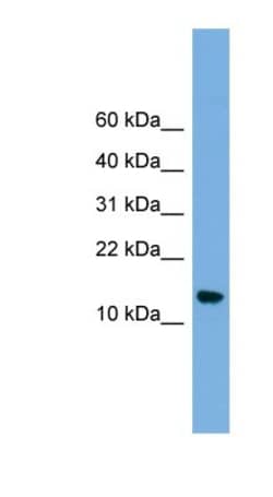 LSM8 Antibody, Novus Biologicals 100&mu;L; Unlabeled:Antibodies, Polyclonal