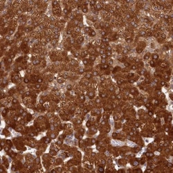 LSS Antibody, Novus Biologicals:Antibodies:Primary Antibodies