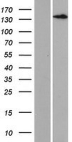 Novus Biologicals&trade;&nbsp;LTBP3 Overexpression Lysate
