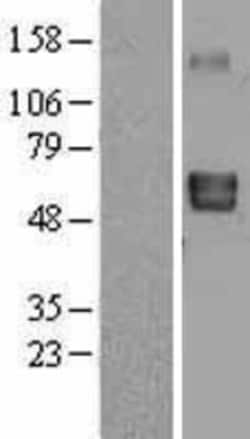 Novus Biologicals™ Lymphotoxin beta R/TNFRSF3 Overexpression Lysate