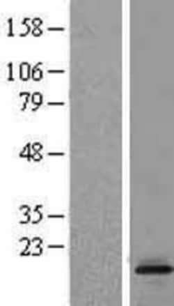 Novus Biologicals™ LTC4S Overexpression Lysate