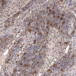 LTV1 Antibody, Novus Biologicals:Antibodies:Primary Antibodies