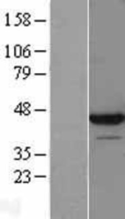 Novus Biologicals&trade;&nbsp;LUC7L Overexpression Lysate