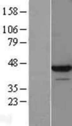Novus Biologicals&trade;&nbsp;LUC7L Overexpression Lysate