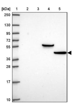 Lunatic Fringe Antibody, Novus Biologicals 0.1mL; Unlabeled:Antibodies,