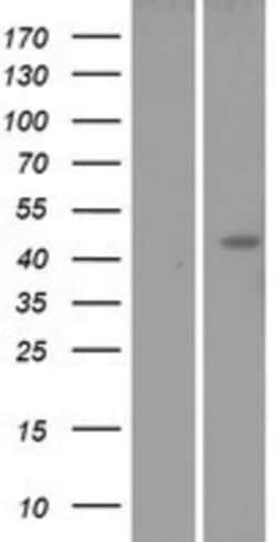 Novus Biologicals&trade;&nbsp;Lunatic Fringe Overexpression Lysate
