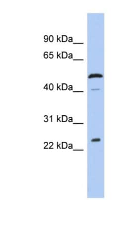 LURAP1 Antibody, Novus Biologicals 100&mu;L; Unlabeled:Antibodies, Polyclonal