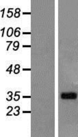 Novus Biologicals&trade;&nbsp;LUZP4 Overexpression Lysate
