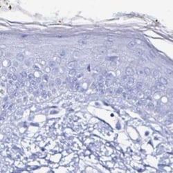 LUZP4 Antibody, Novus Biologicals:Antibodies:Primary Antibodies