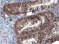Latexin Antibody (OTI1E10), Novus Biologicals 0.1mL; Unlabeled:Antibodies,