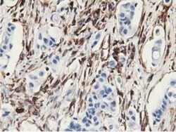 Latexin Antibody (OTI1E10), Novus Biologicals 0.1mL; Unlabeled:Antibodies,