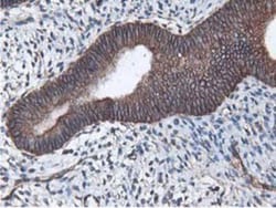 Latexin Antibody (OTI1E10), Novus Biologicals 0.1mL; Unlabeled:Antibodies,