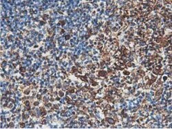 Latexin Antibody (OTI1E10), Novus Biologicals 0.1mL; Unlabeled:Antibodies,