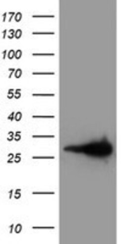 Latexin Antibody (OTI1E10), Novus Biologicals 0.1mL; Unlabeled:Antibodies,