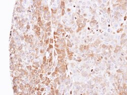 Latexin Antibody, Novus Biologicals 0.1mg; Unlabeled:Antibodies, Polyclonal