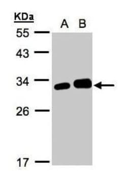Latexin Antibody, Novus Biologicals 0.1mg; Unlabeled:Antibodies, Polyclonal