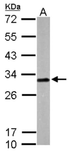 Latexin Antibody, Novus Biologicals 0.1mg; Unlabeled:Antibodies, Polyclonal