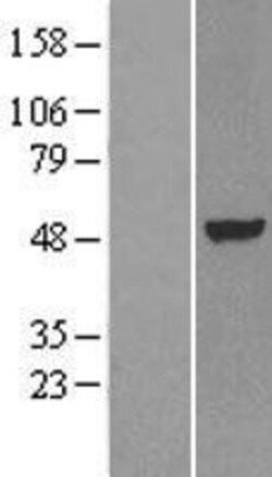 Novus Biologicals™ LXR alpha/NR1H3 Overexpression Lysate