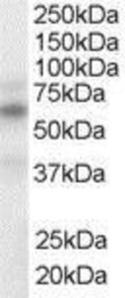 LXR alpha/beta Antibody, Novus Biologicals 0.1mg; Unlabeled:Antibodies,