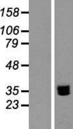 R&D Systems&trade;&nbsp;NTB-A/SLAMF6/CD352 Overexpression Lysate