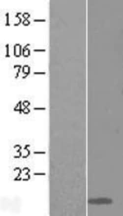 Novus Biologicals&trade;&nbsp;Ly-6D Overexpression Lysate