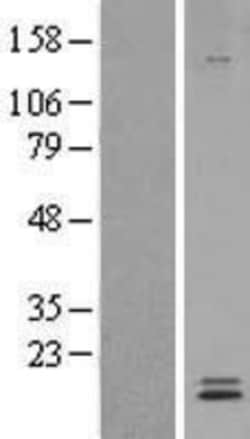 Novus Biologicals&trade;&nbsp;Ly-6E Overexpression Lysate