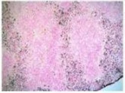 Ly-6G/Ly-6C Antibody (NIMP-R14), Novus Biologicals 0.05mg; Unlabeled:Antibodies,