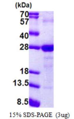 Novus Biologicals&trade;&nbsp;Recombinant Human Ly-6G6F His Protein