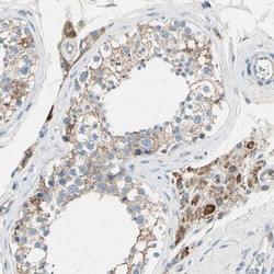 Ly-6G6F Antibody, Novus Biologicals:Antibodies:Primary Antibodies