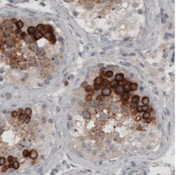 Ly6K Antibody (CL2435), Novus Biologicals:Antibodies:Primary Antibodies