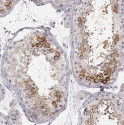 Ly6K Antibody, Novus Biologicals:Antibodies:Primary Antibodies