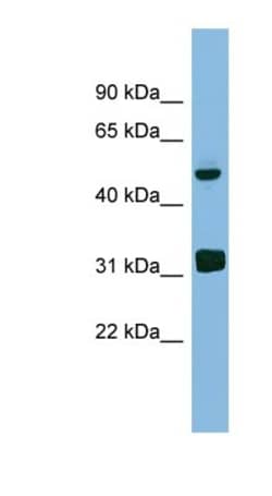 LYAR Antibody, Novus Biologicals 100&mu;L; Unlabeled:Antibodies, Polyclonal