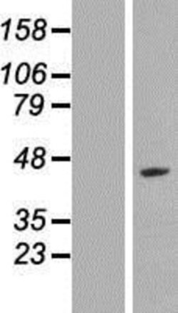 Novus Biologicals&trade;&nbsp;LYAR Overexpression Lysate