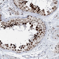 MTO1 Antibody, Novus Biologicals:Antibodies:Primary Antibodies