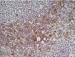 Ly-6C Antibody (ER-MP20) - BSA Free, Novus Biologicals 0.1 mg; Unconjugated:Antibodies,