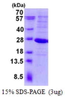 Novus Biologicals&trade;&nbsp;Recombinant Human LYG2 His Protein