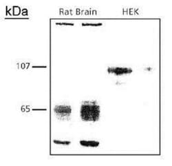 Novus Biologicals Lymphoma Markers Antibody Pack 2 vials:Antibodies