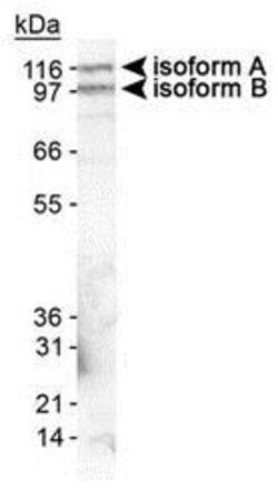 Novus Biologicals Lymphoma Markers Antibody Pack 2 vials:Antibodies