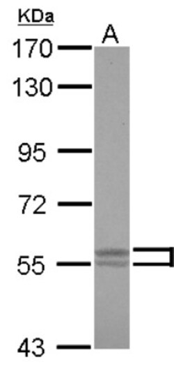 Lyn Antibody, Novus Biologicals 0.1mL; Unlabeled:Antibodies, Polyclonal