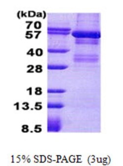 Novus Biologicals&trade;&nbsp;Recombinant Human Lyn His Protein