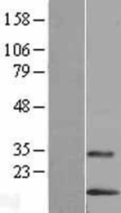Novus Biologicals&trade;&nbsp;LYNX1 Overexpression Lysate