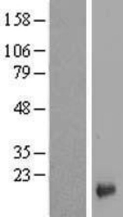 Novus Biologicals&trade;&nbsp;LYPD1 Overexpression Lysate