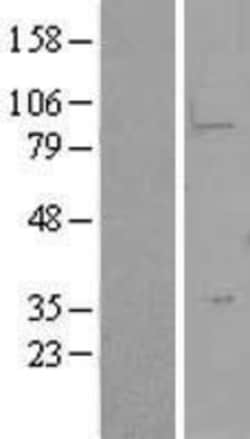 Novus Biologicals™ LYPD5 Overexpression Lysate