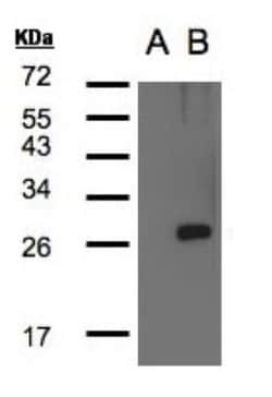 LYPLA1 Antibody, Novus Biologicals 0.1mL; Unlabeled:Antibodies, Polyclonal