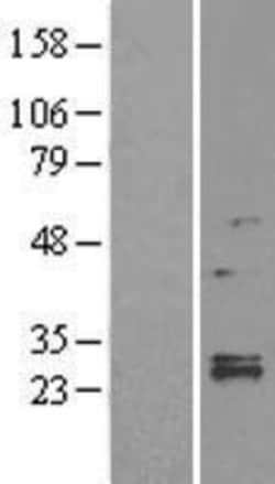Novus Biologicals™ LYPLA1 Overexpression Lysate
