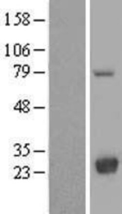 Novus Biologicals&trade;&nbsp;LYPLA2 Overexpression Lysate